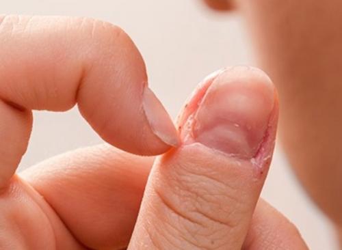 На днях ехала в маршрутке и смотрела на мальчишку с такой, как бы это сказать …, психологической полнотой. 01 На днях ехала в маршрутке и смотрела на мальчишку с такой, как бы это сказать …, психологической полнотой. 01