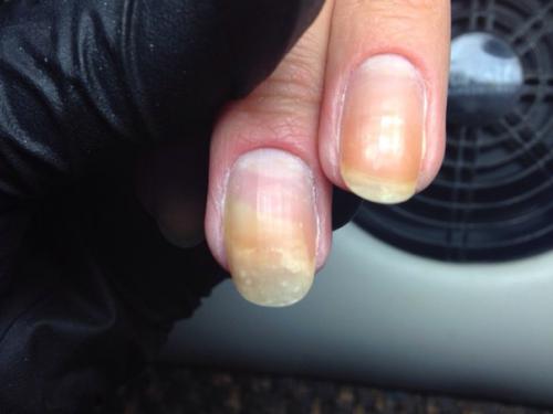 Девушки, выручайте!  Сегодня пришла девушка вот с таким ноготком! 01